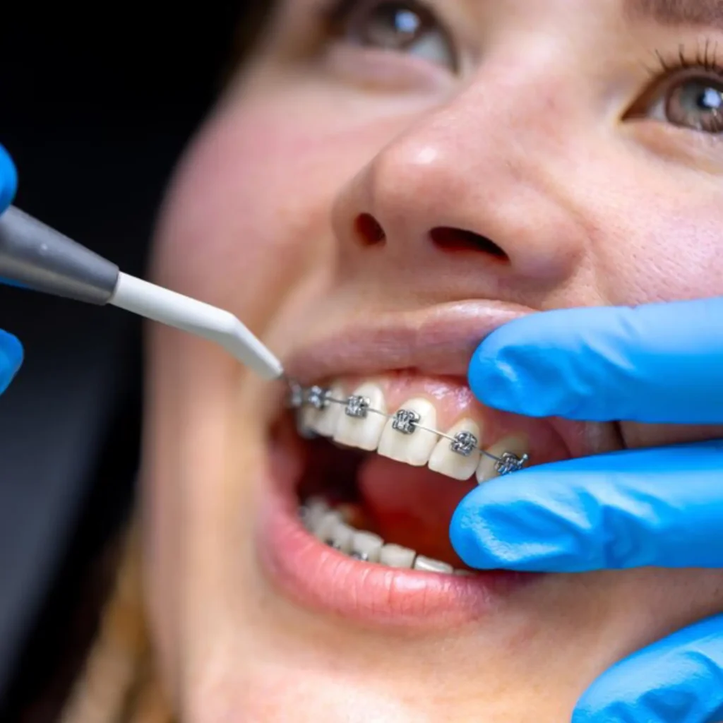 Tratamientos dentales DeBoca Madrid